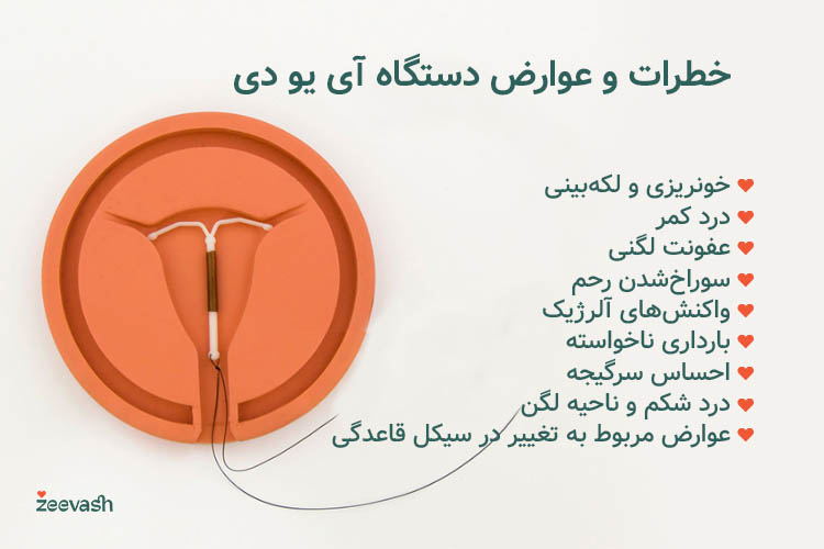 خطرات و عوارض آی یو دی شامل عفونت، سوراخشدن رحم و در موارد نادر بارداری ناخواسته است.